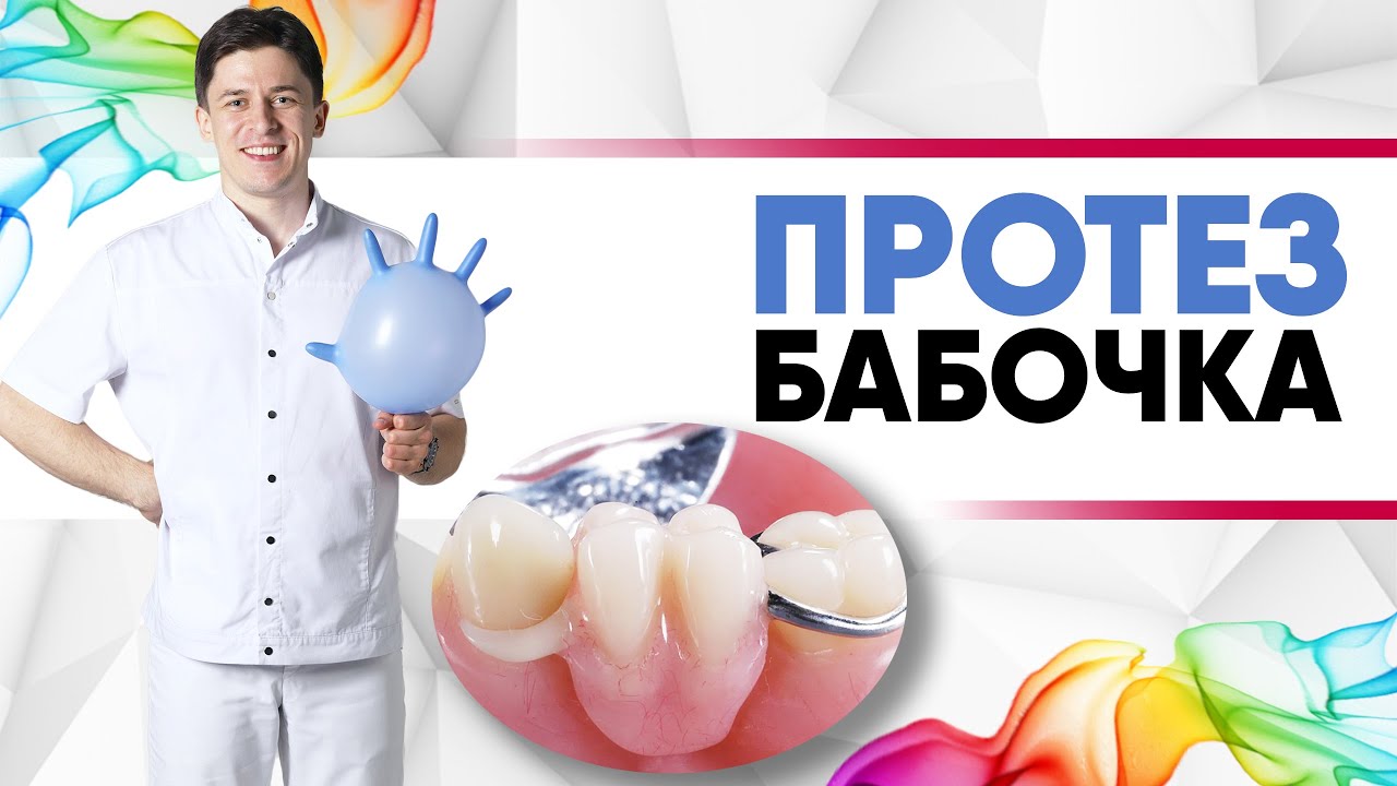 Протез бабочка [ птичка, флиппер ] - съёмный микропротез для восстановления одного или 2/3 зубов.