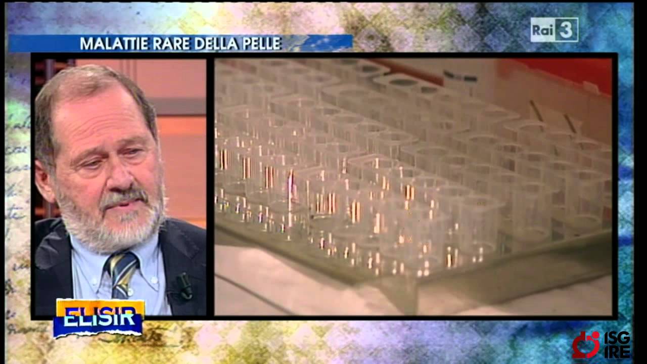Elisir intervista il Dr. Biolcati sulle malattie rare della pelle