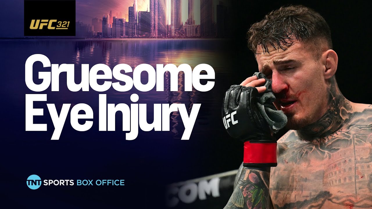 EMOTIONAL SCENES! Tom Aspinall retains title after eye injury forces no contest against Gane 