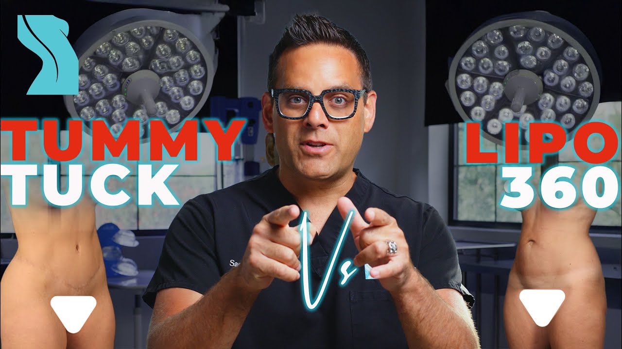 Tummy Tuck vs Lipo 360 Which Is Right for You?