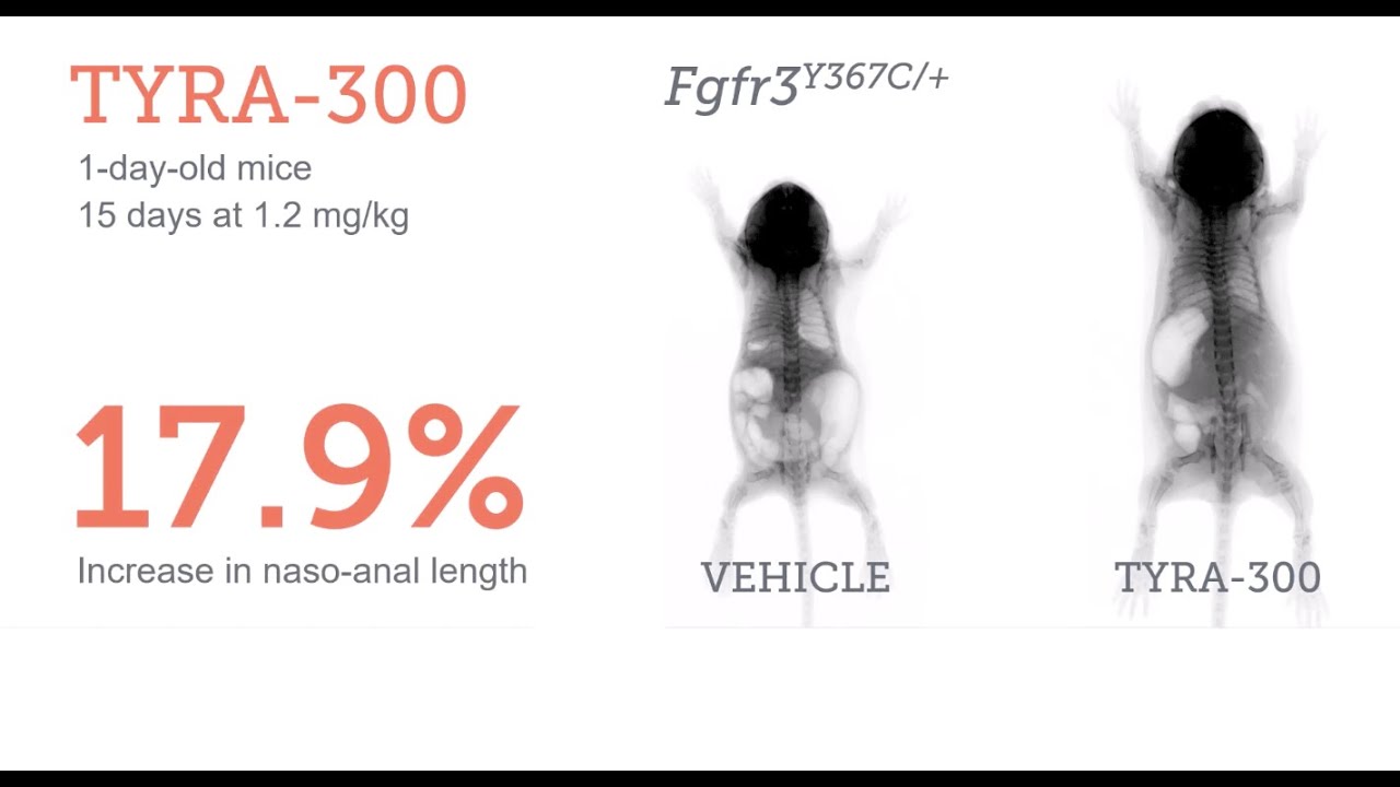 Bone growth promotion in two FGFR3-driven models of chondrodysplasia