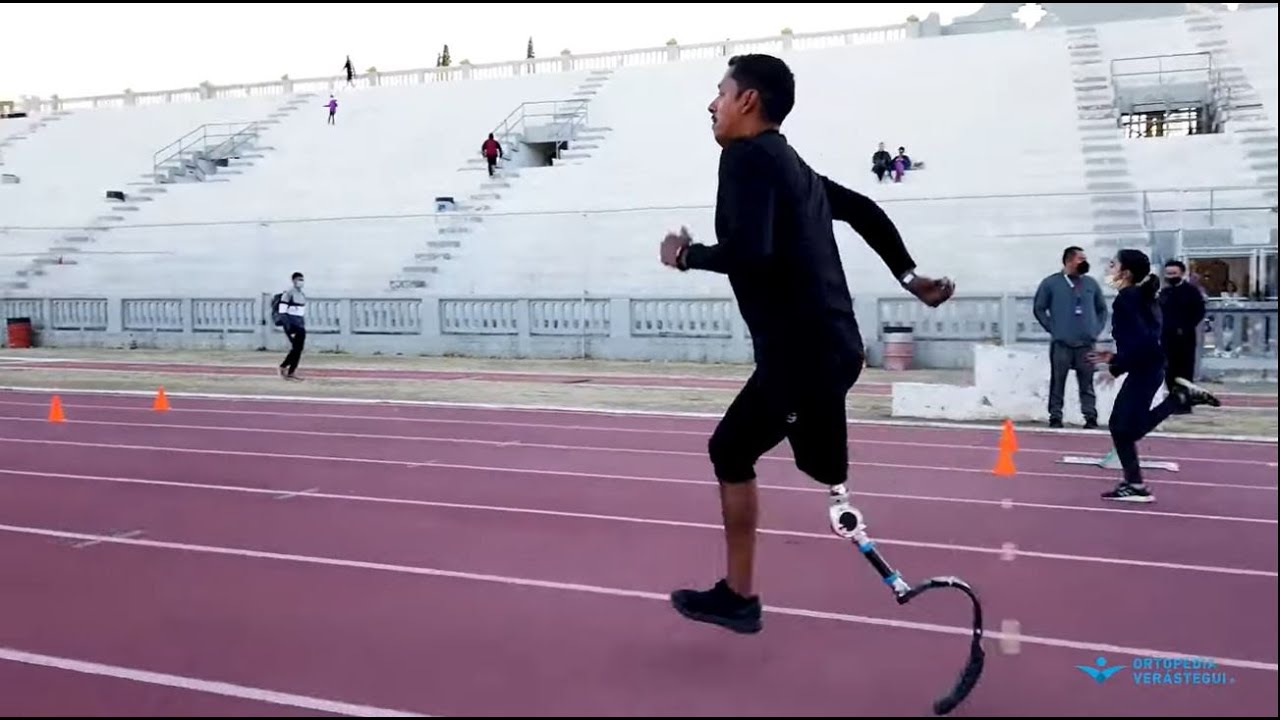 Episodio 89 Volver a trotar con prótesis arriba de rodilla, Charly en acción.