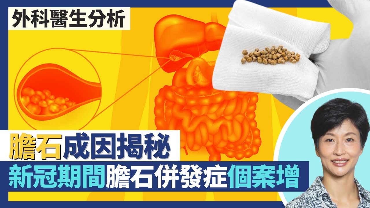 膽石成因揭秘 4F人士膽石風險大增！新冠肺炎疫情期間患膽石出現併發症個案增！膽汁膽固醇及鹽份過高易結石都會遺傳？｜王建芳醫生 陳詩正醫生｜人類健康研究所