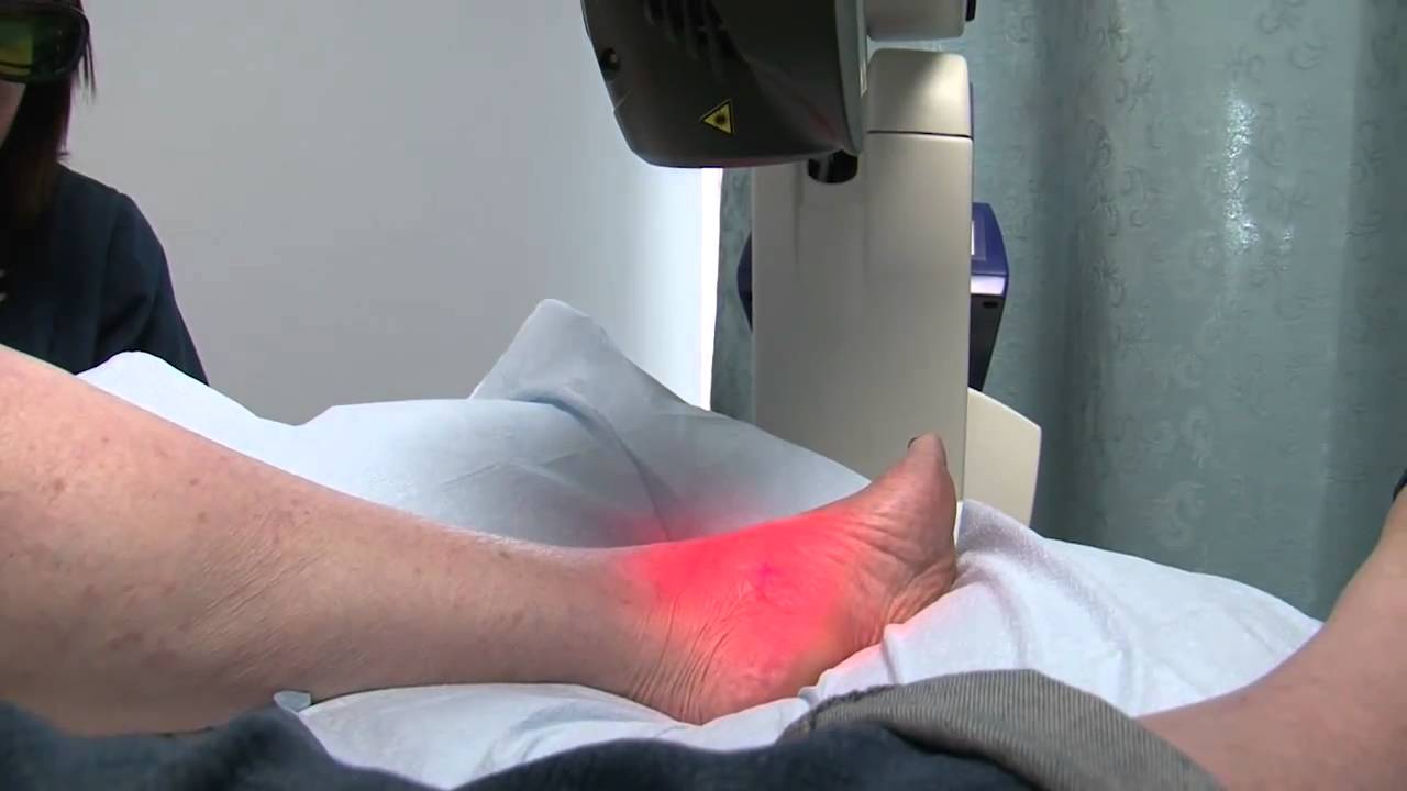 MLS Laser Therapy in Pain Management