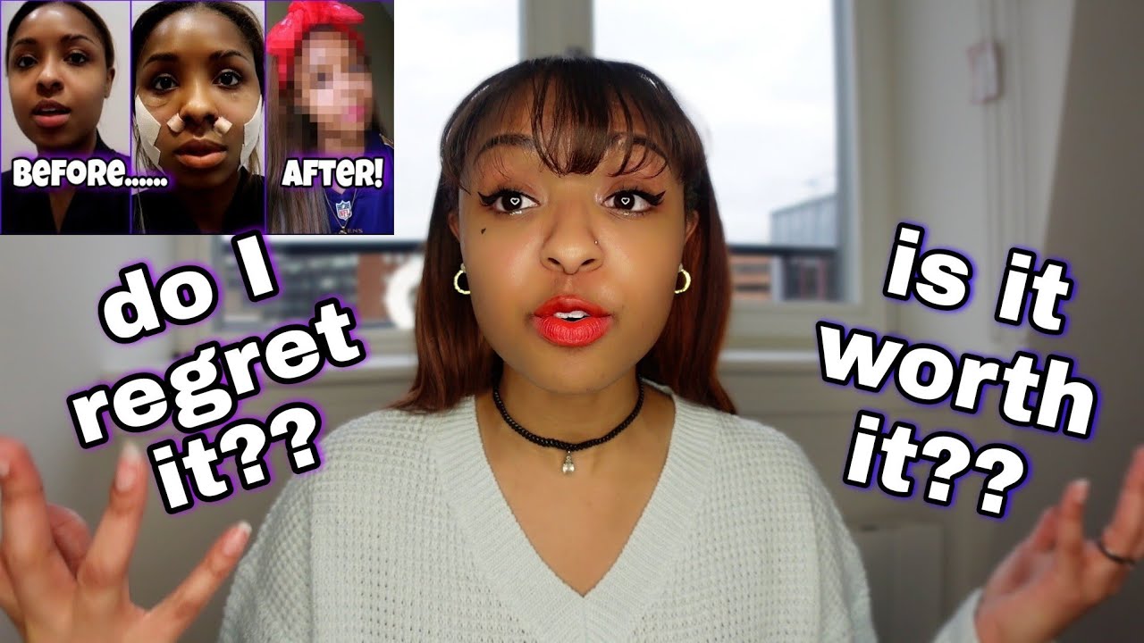My Korean plastic surgery update! 1 year later