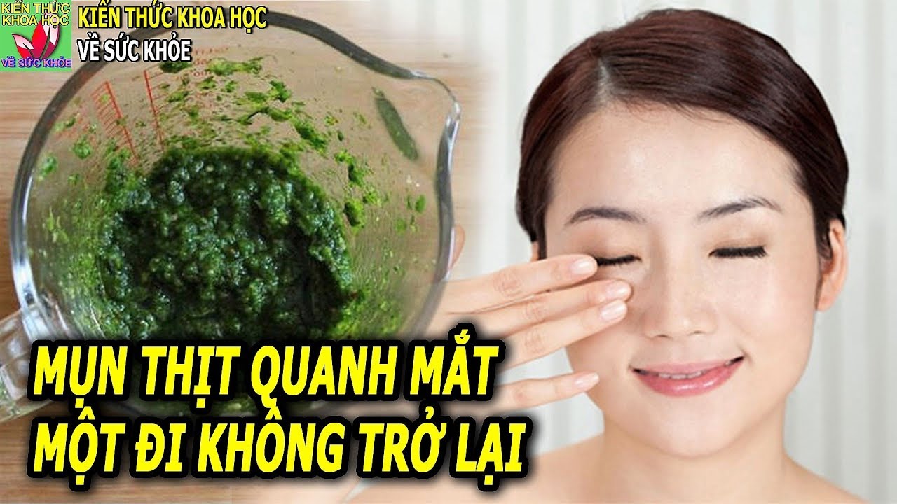 Mụn thịt quanh mắt nhiều cỡ nào cũng tự khắc biến mất với cách đơn giản này