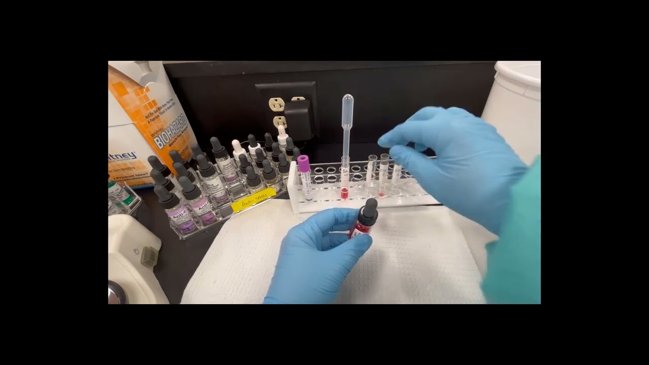 BB Lab Antigen Typing