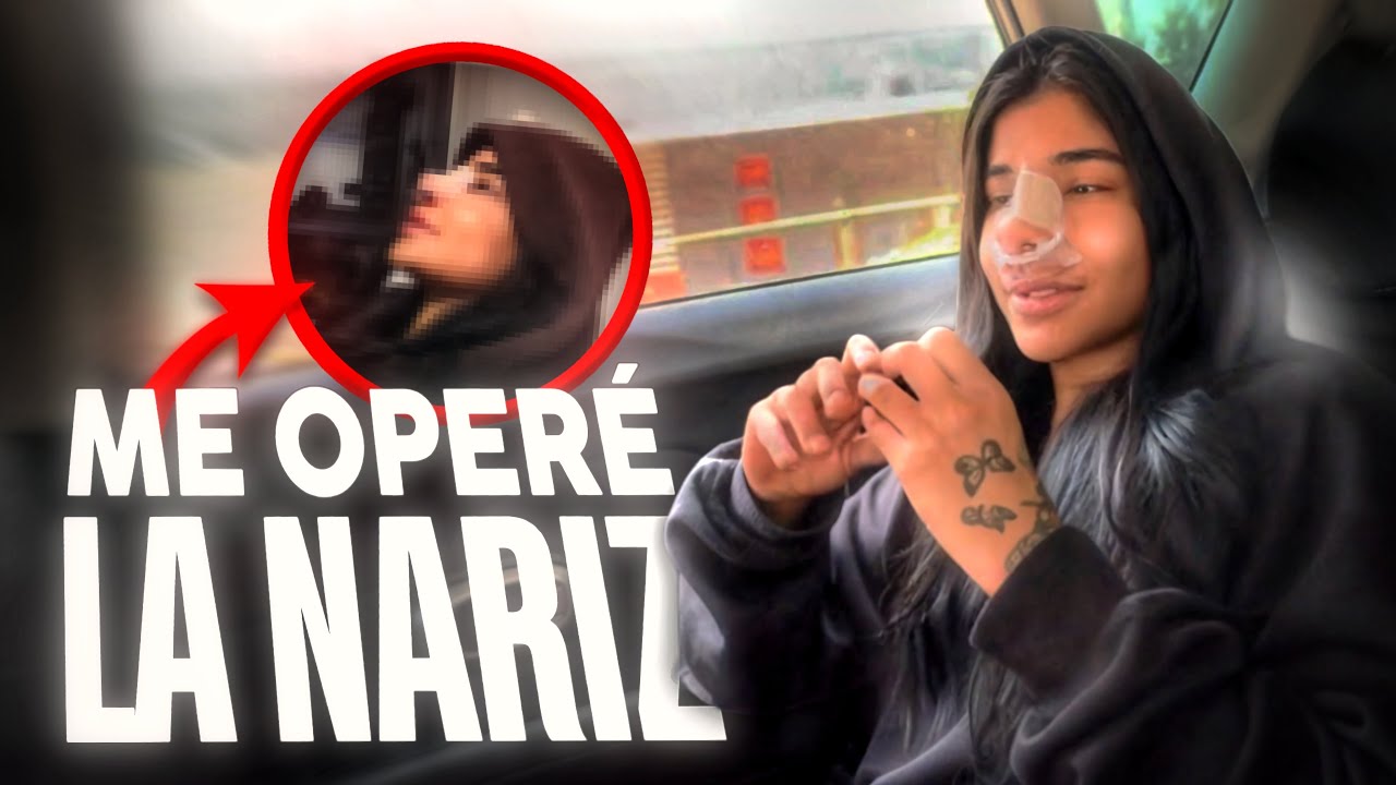 ME OPERÉ (ENFERMERA POR 24 HORAS) | YURI Y VALE