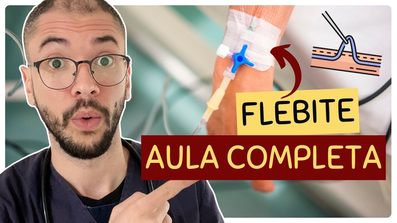 O QUE &Eacute; FLEBITE E COMO IDENTIFICAR? | AULA COMPLETA