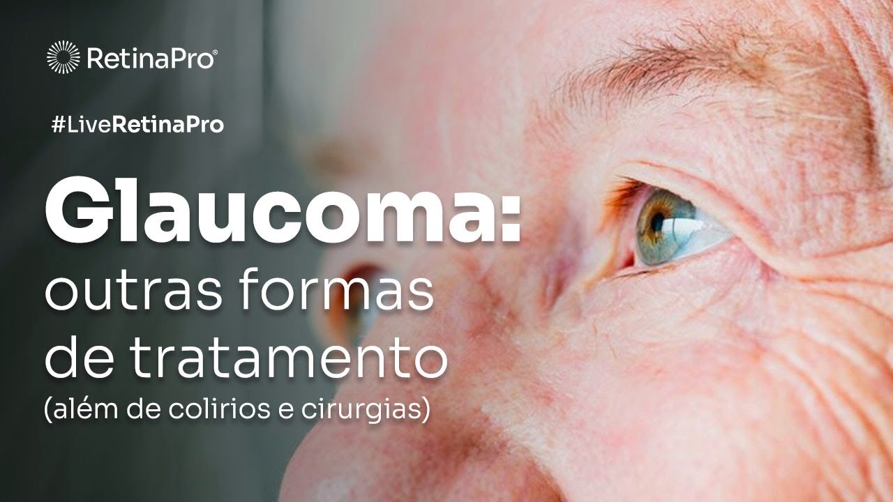 Glaucoma: Outras formas de tratamento além de colirios e cirurgias.