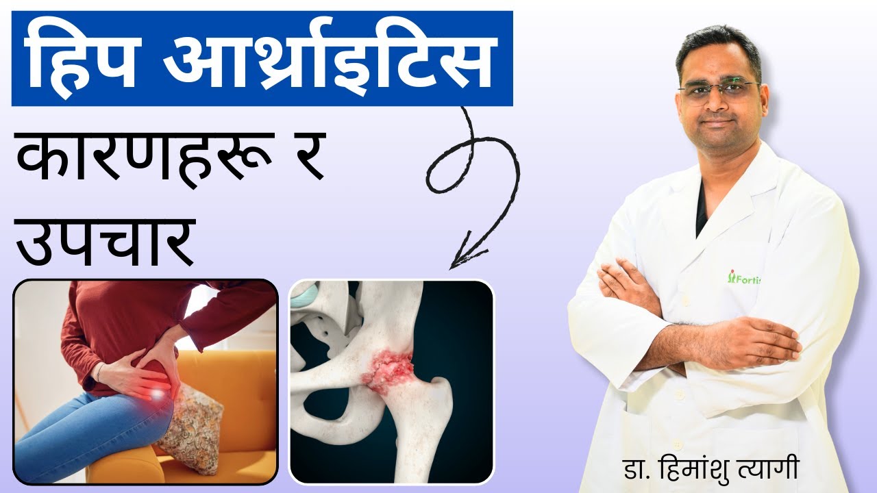 हिप आर्थ्राइटिस – कारणहरू र उपचार | Hip Arthritis - Causes & Treatment in Nepali