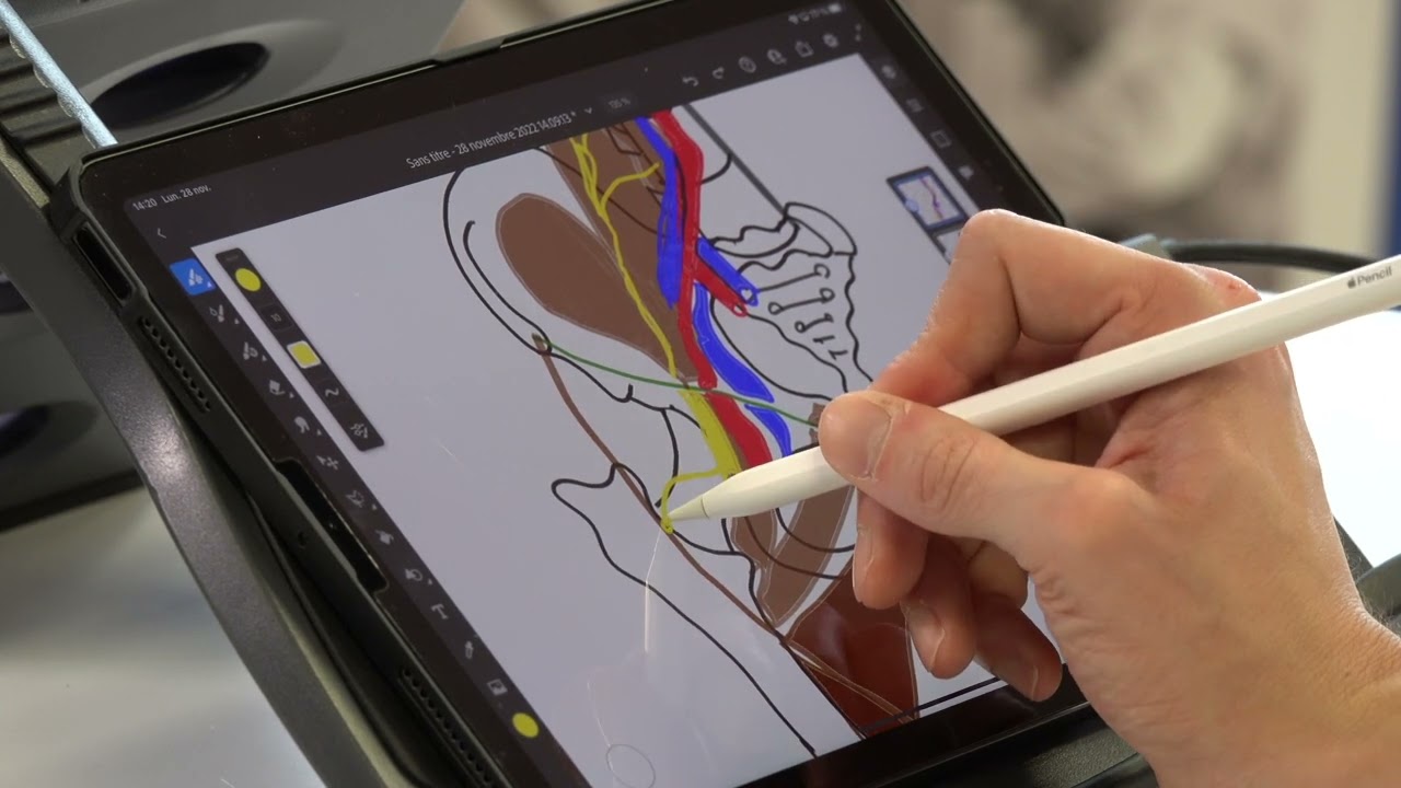 Neurologie du membre Inférieur nerf fémoral