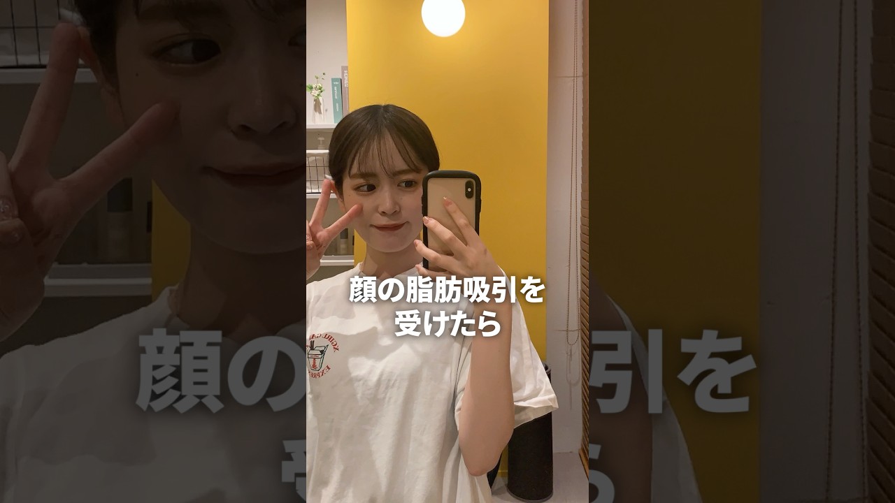 脂肪吸引の失敗から立ち直るまでの3年間まとめ　#shorts