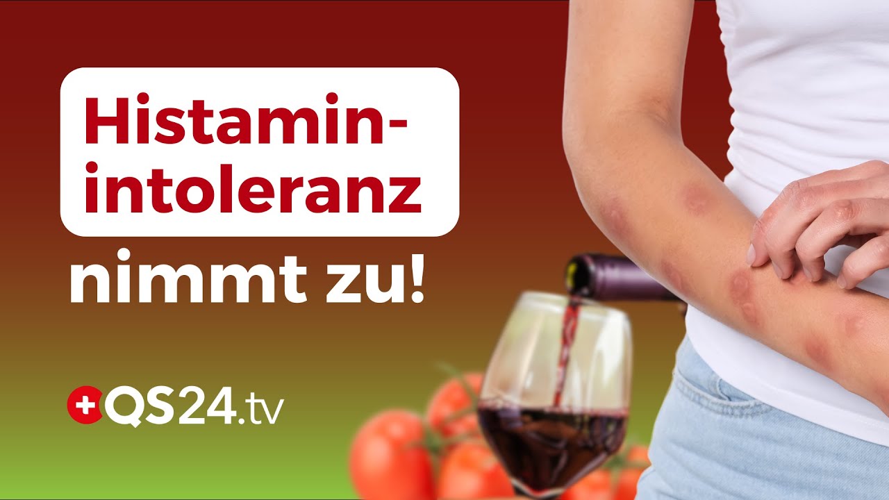 Histaminintoleranz: Warum der Verzicht auf Histamin nicht die einzige Lösung ist | QS24