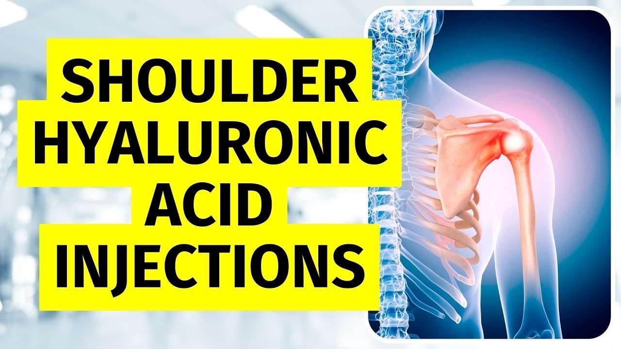 Hyaluronic Acid Injection for Rotator Cuff and Shoulder Pain