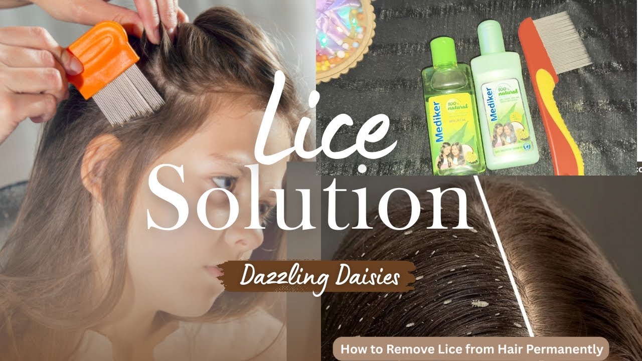 How To Clear Lice & Nits ?? Solution For Lice !!