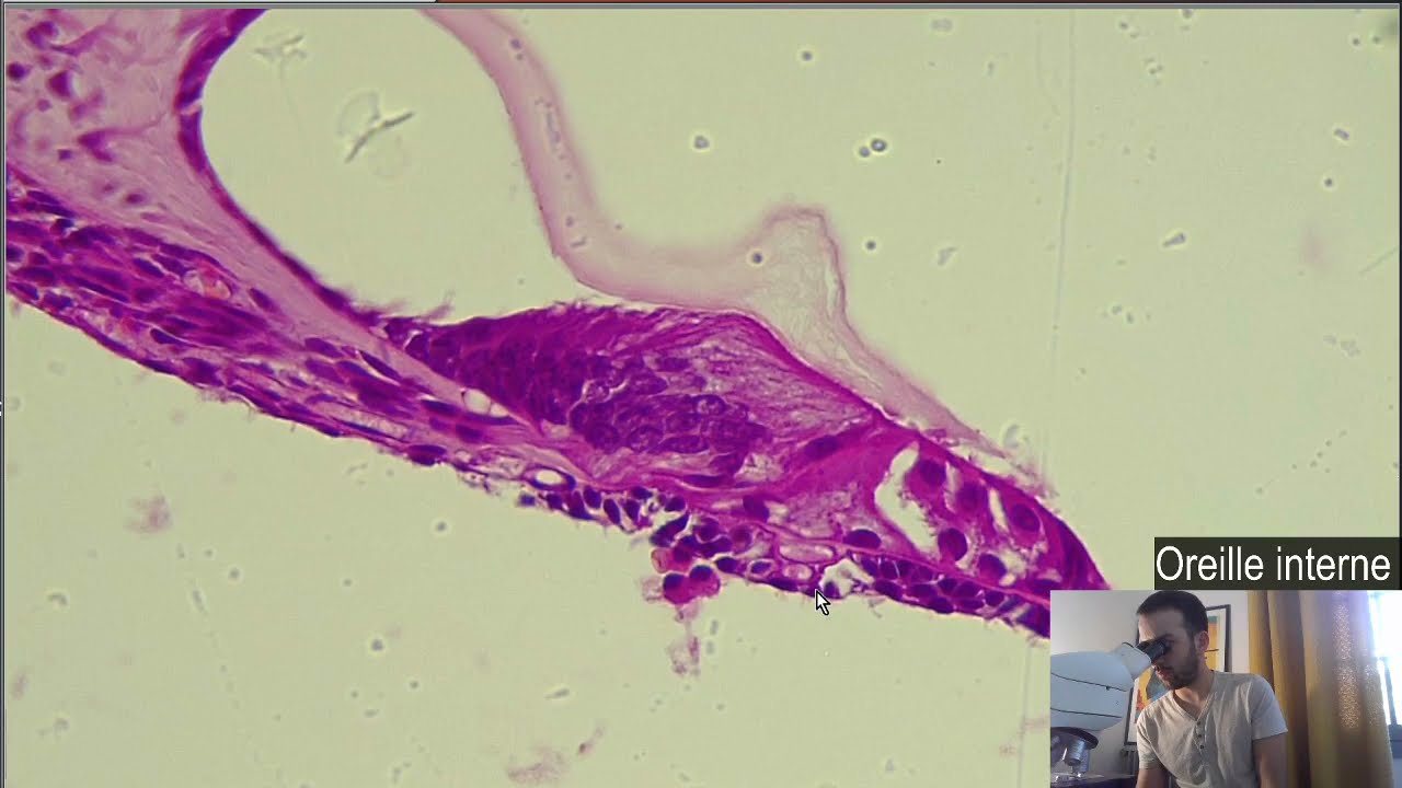 Histologie - L'oreille interne, Cochl&eacute;e et Organe de Corti