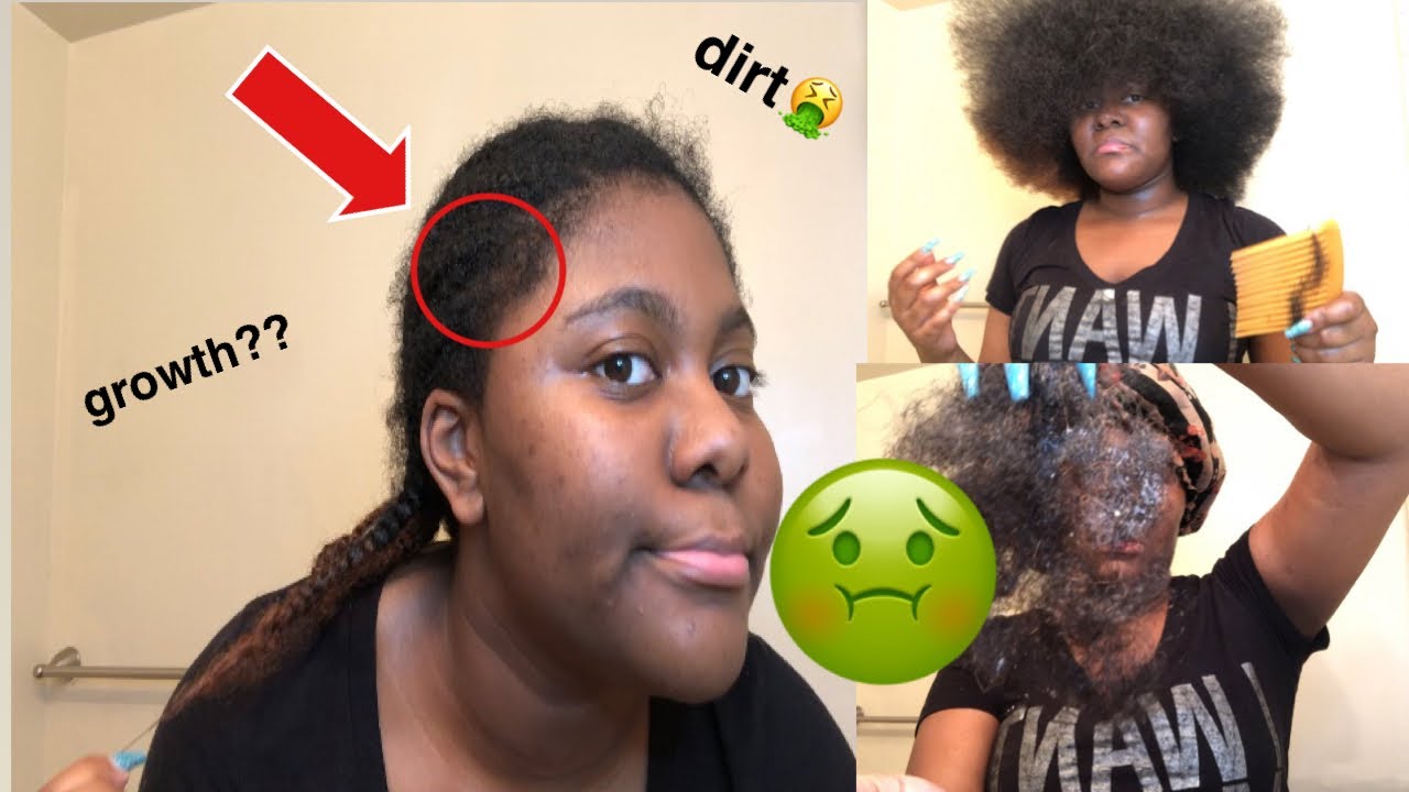 Watch Me Take Down 1 MONTH OLD CORNROWS 😷 *beware*