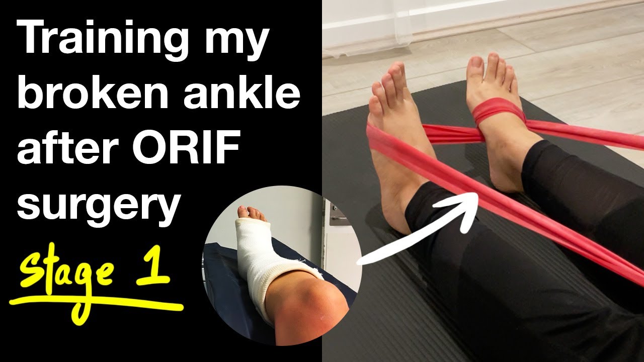 Training my broken ankle after ORIF surgery - stage 1