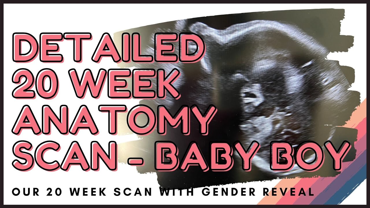 ANATOMY SCAN BABY BOY! | 20 WEEKS | UK MUM VLOG
