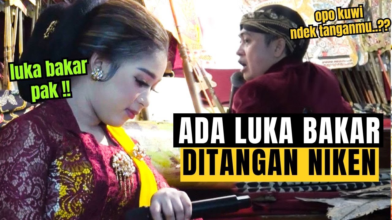 Ternyata Ditangan Niken Salindry Ada Luka Bakar, Kok Bisa Ya ???