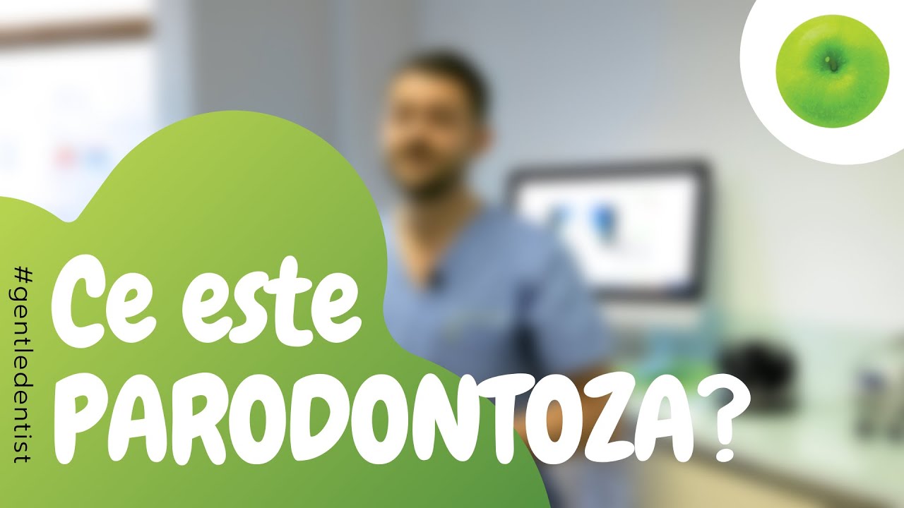 Ce este parodontoza?