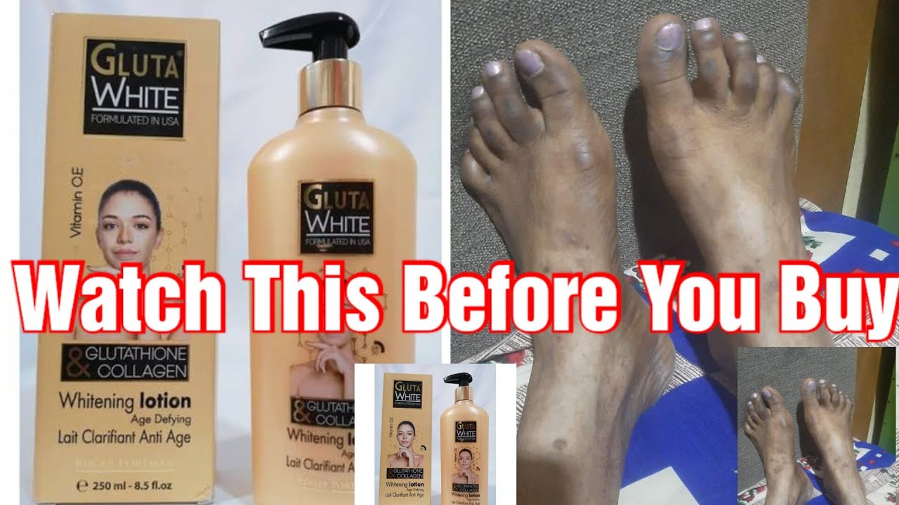 PLEASE WATCH THIS BEFORE BUYING GLUTA WHITE LOTION #review @itstreasure9917