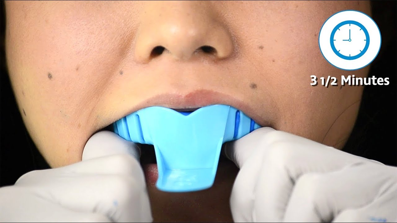 SnapCorrect Impression Guide