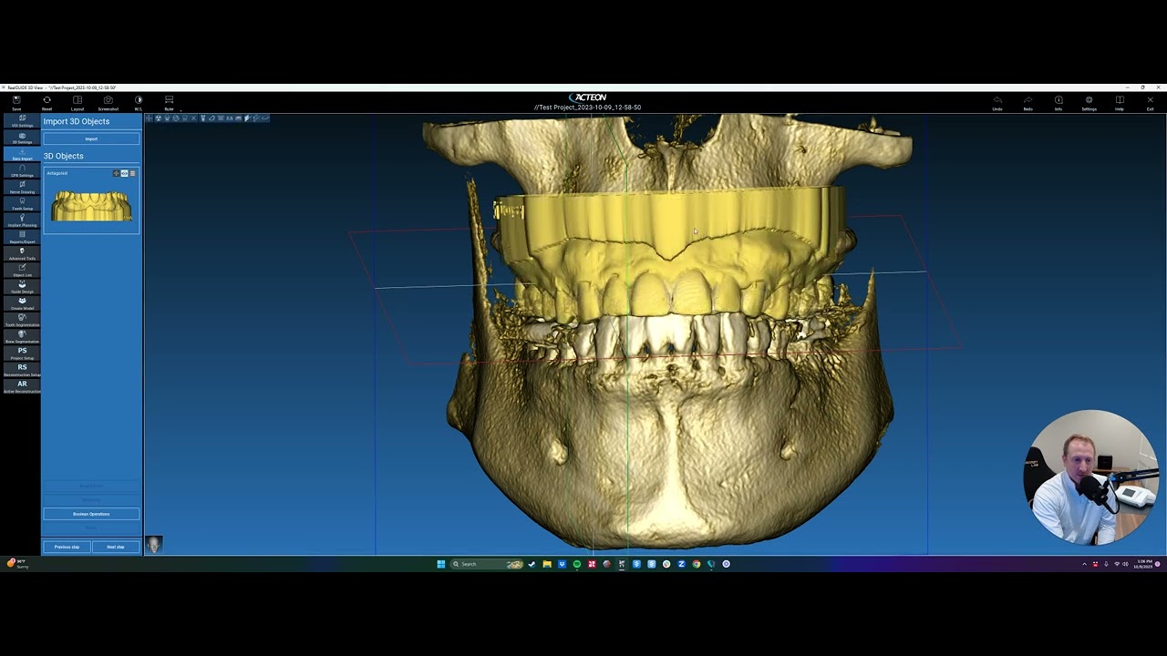6.0: Acteon Walkthrough Videos - Data Import