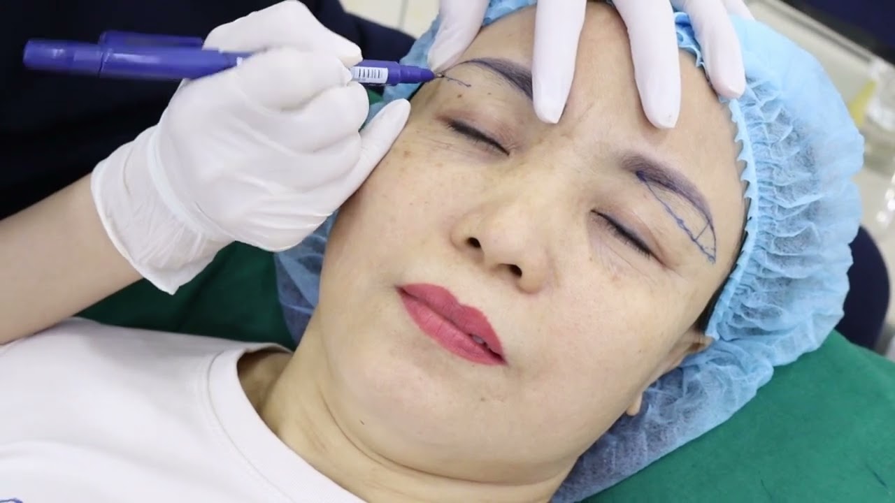 CON GÁI TÌM HIỂU KỸ RỒI MỚI DÁM KÊU MẸ ĐẾN DR.DUY: KẾT QUẢ TREO CUNG MÀY MỸ MÃN!