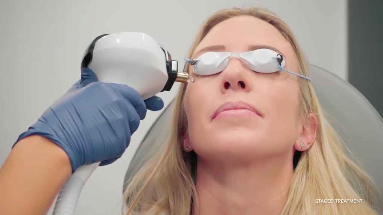 Lumecca I Treatment