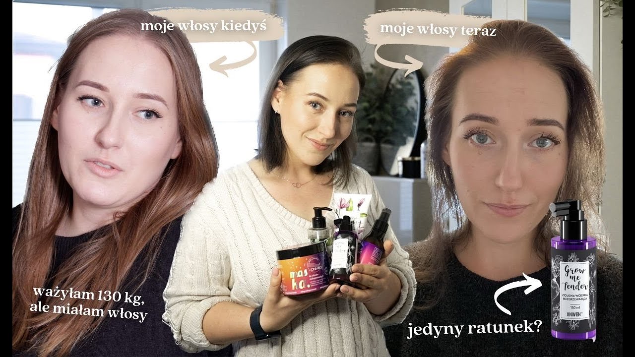 SCHUDŁAM ze 130 kg i straciłam włosy 😖😭