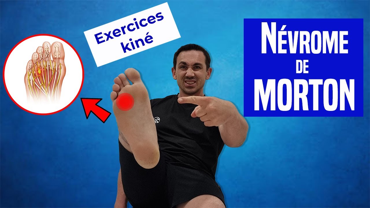 Soulager le Névrome de Morton : Exercices Kiné