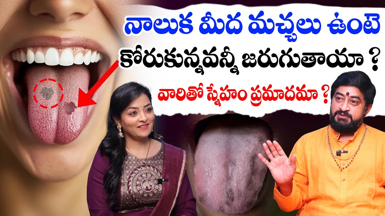 Astrologer Sudheer Sharma : నాలుక మీద మచ్చలు ఉంటె కోరుకున్నవన్నీ జరుగుతాయా ? | Black Spots on Tounge