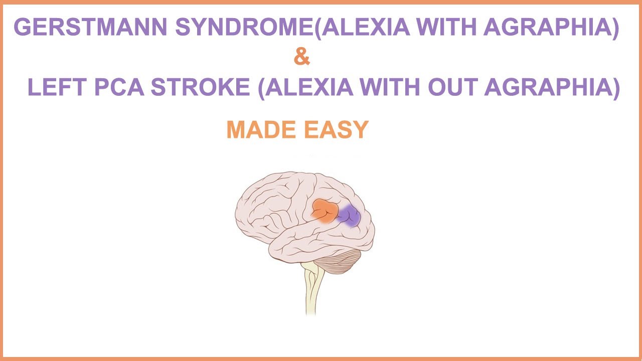 GERSTMANN SYNDROME(ALEXIA WITH AGRAPHIA) & LEFT PCA STROKE(ALEXIA WITHOUT AGRAPHIA) MADE EASY.