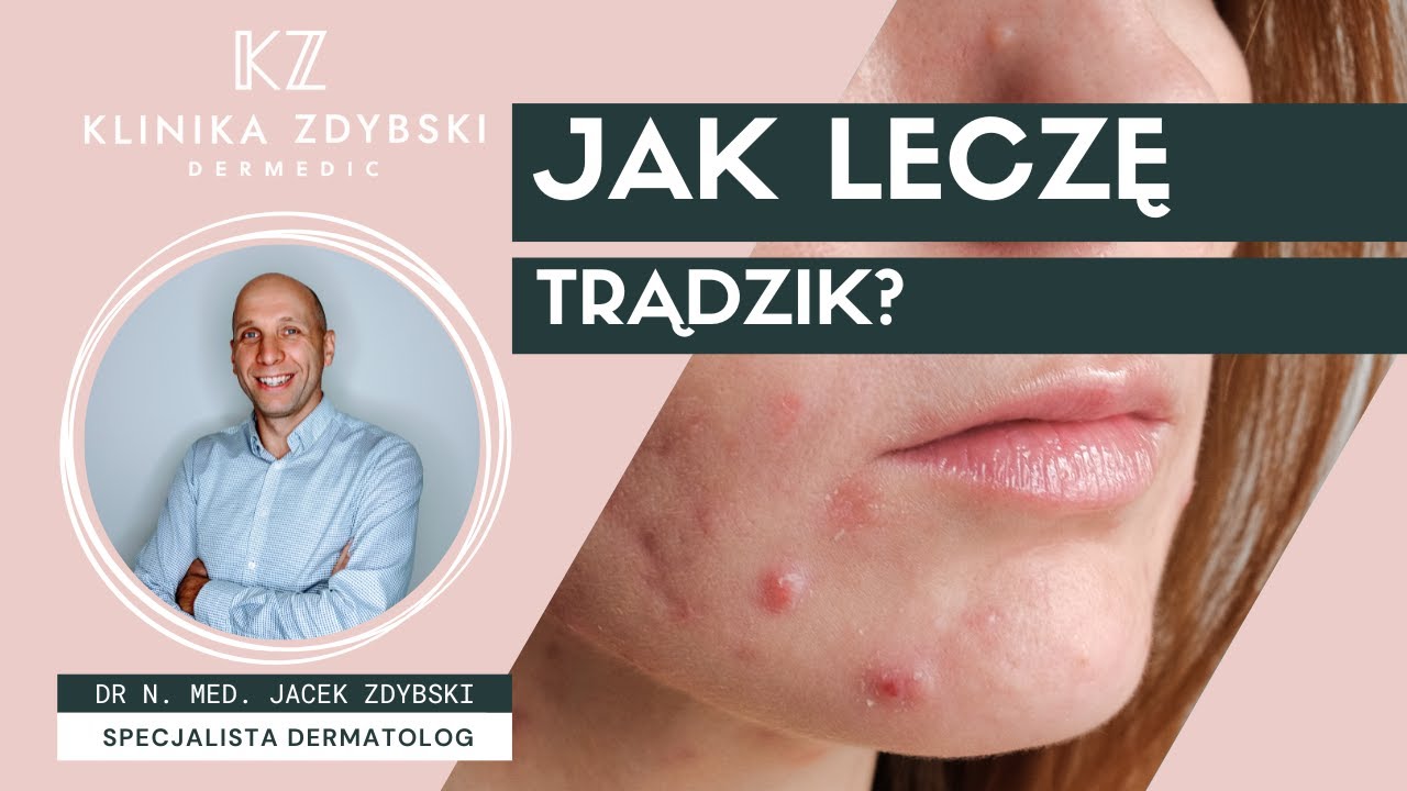 Dermatolog mówi o: Jak leczę trądzik?