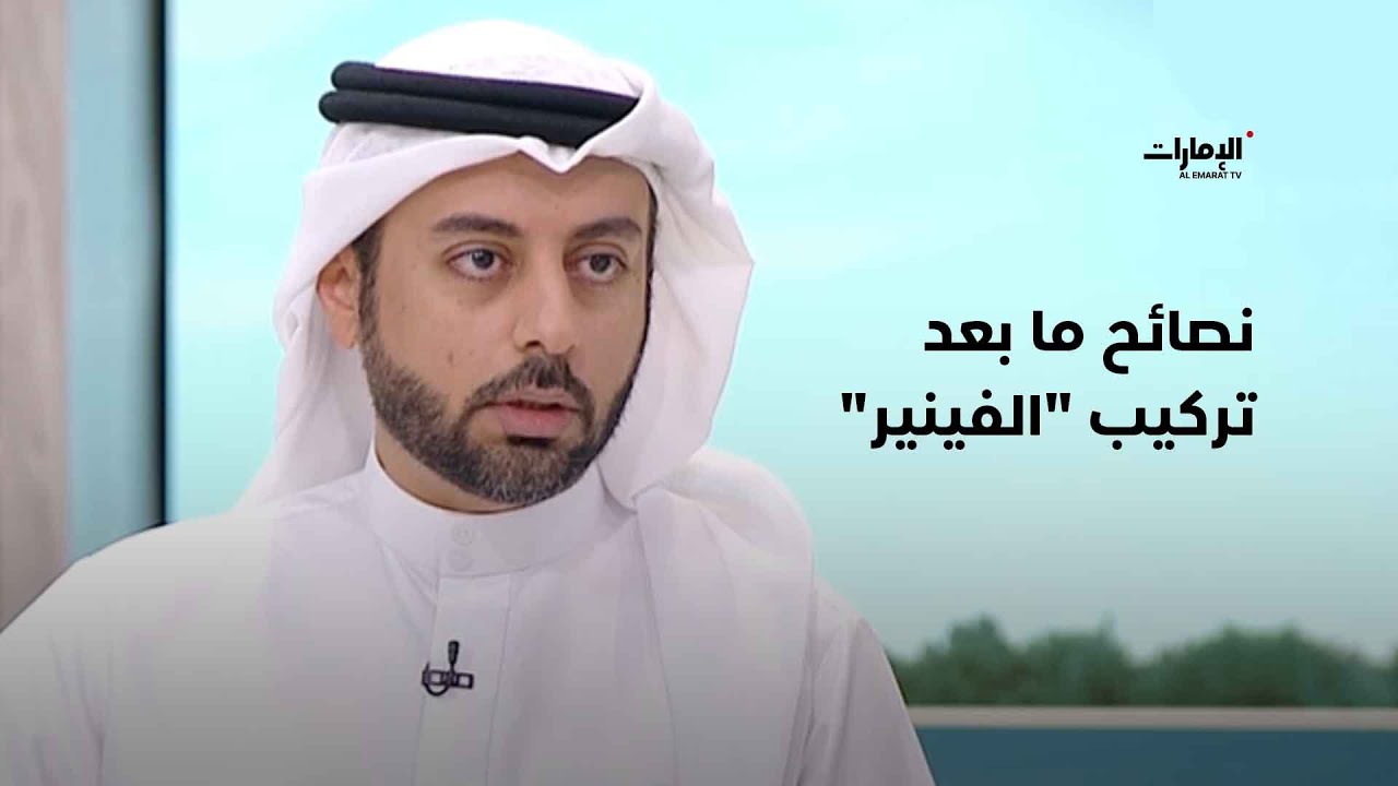 نصائح ما بعد تركيب 