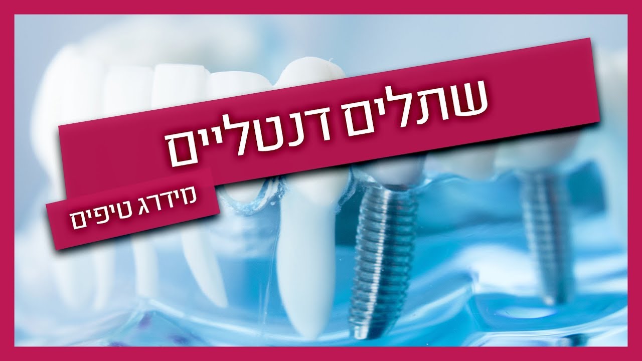 שתלים דנטליים - רופא שיניים מסביר על הטיפול וההחלמה