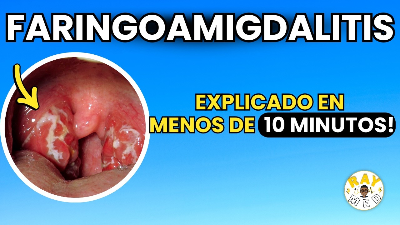 FARINGOAMIGDALITIS: ¿Qué es y cómo tratarla? Te lo explico en menos de 10 MINUTOS!