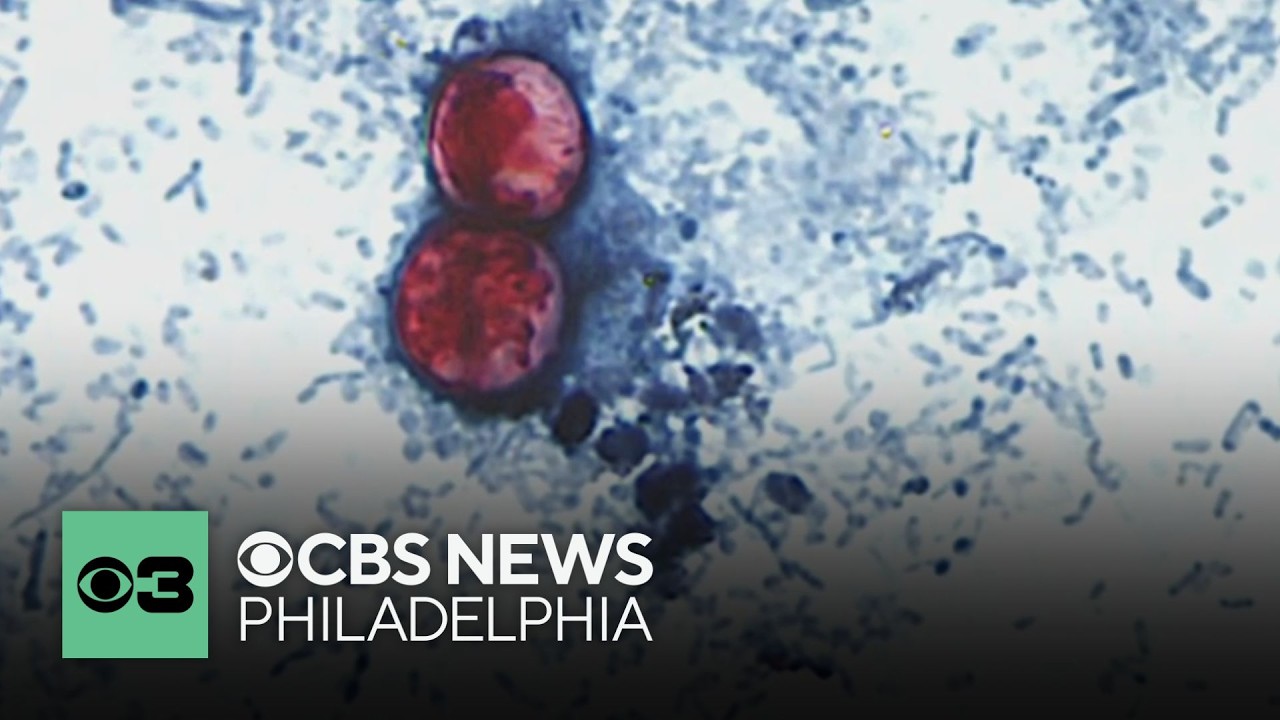 FDA investigating new outbreak of cyclospora parasite