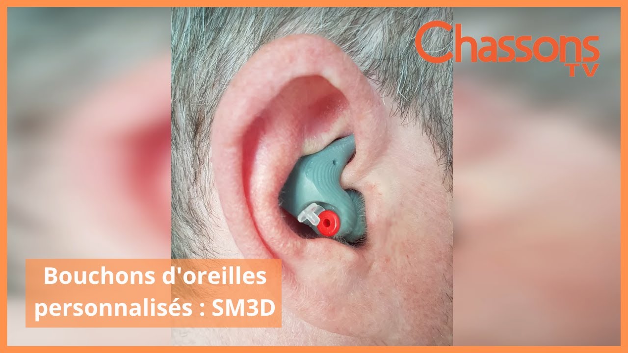 SM3D: Des bouchons d'oreilles personnalis&eacute;s &agrave; 105&euro; envoy&eacute;s &agrave; votre domicile