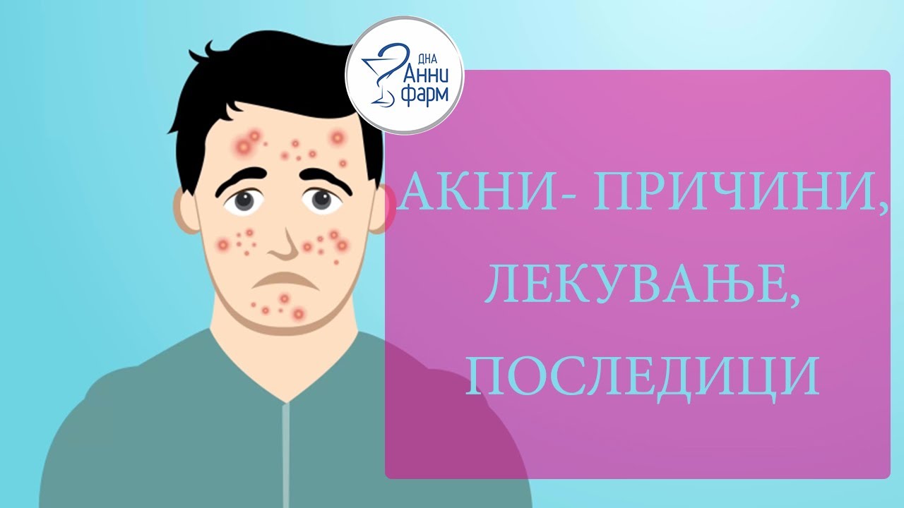 АКНИ- ПРИЧИНИ, ЛЕКУВАЊЕ, ПОСЛЕДИЦИ СО ДР. МАРГАРИТА ЈОВЕСКА-КРСТЕСКА