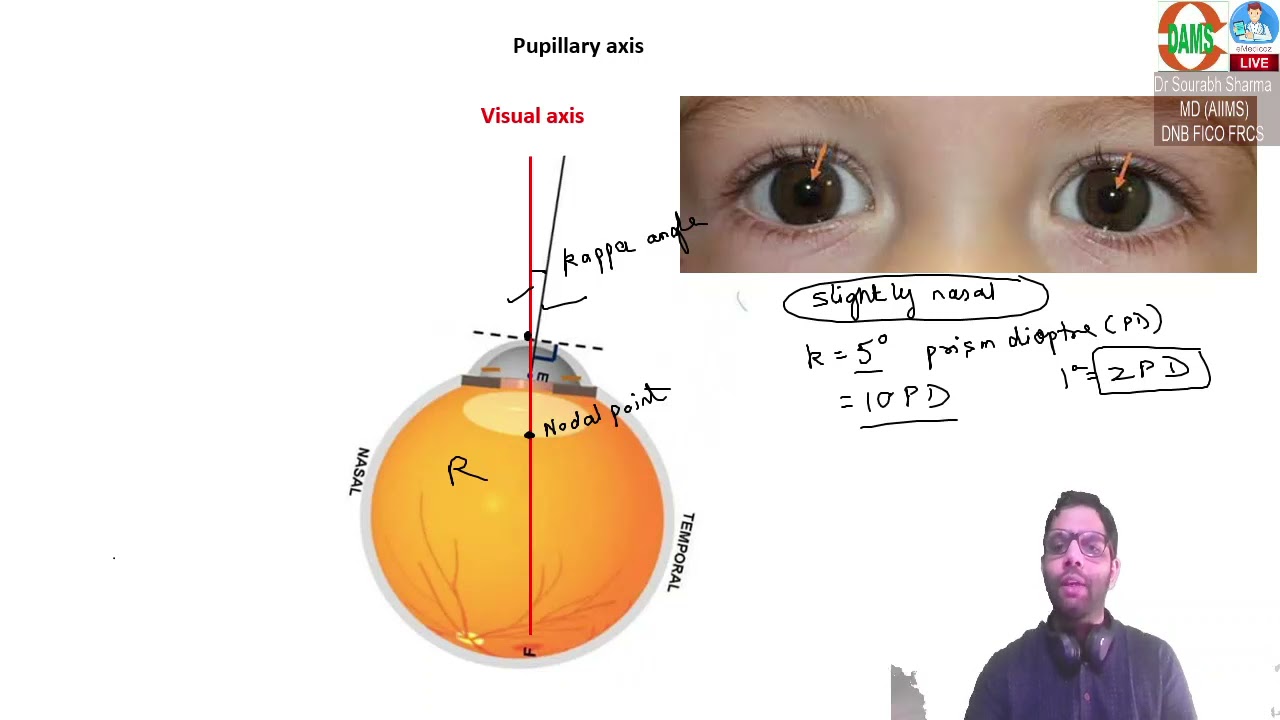 Kappa angle and pseudo strabismus