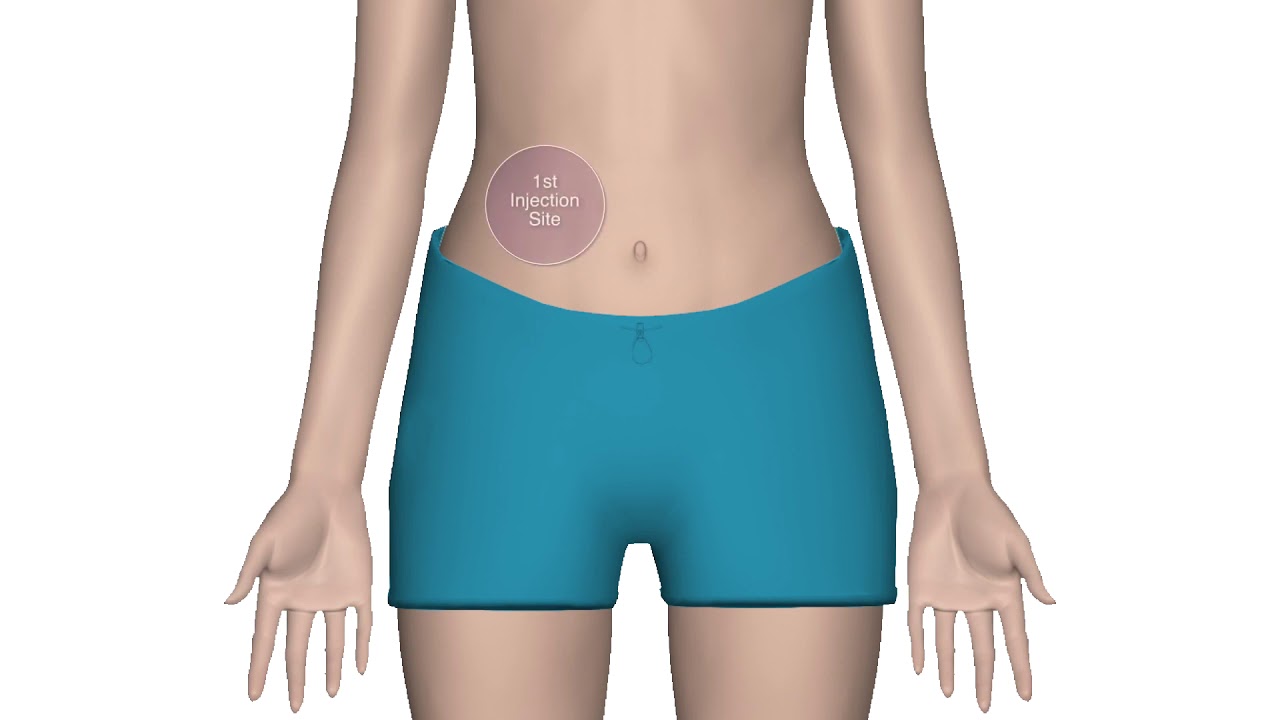 Rekovelle follitropin delta injection