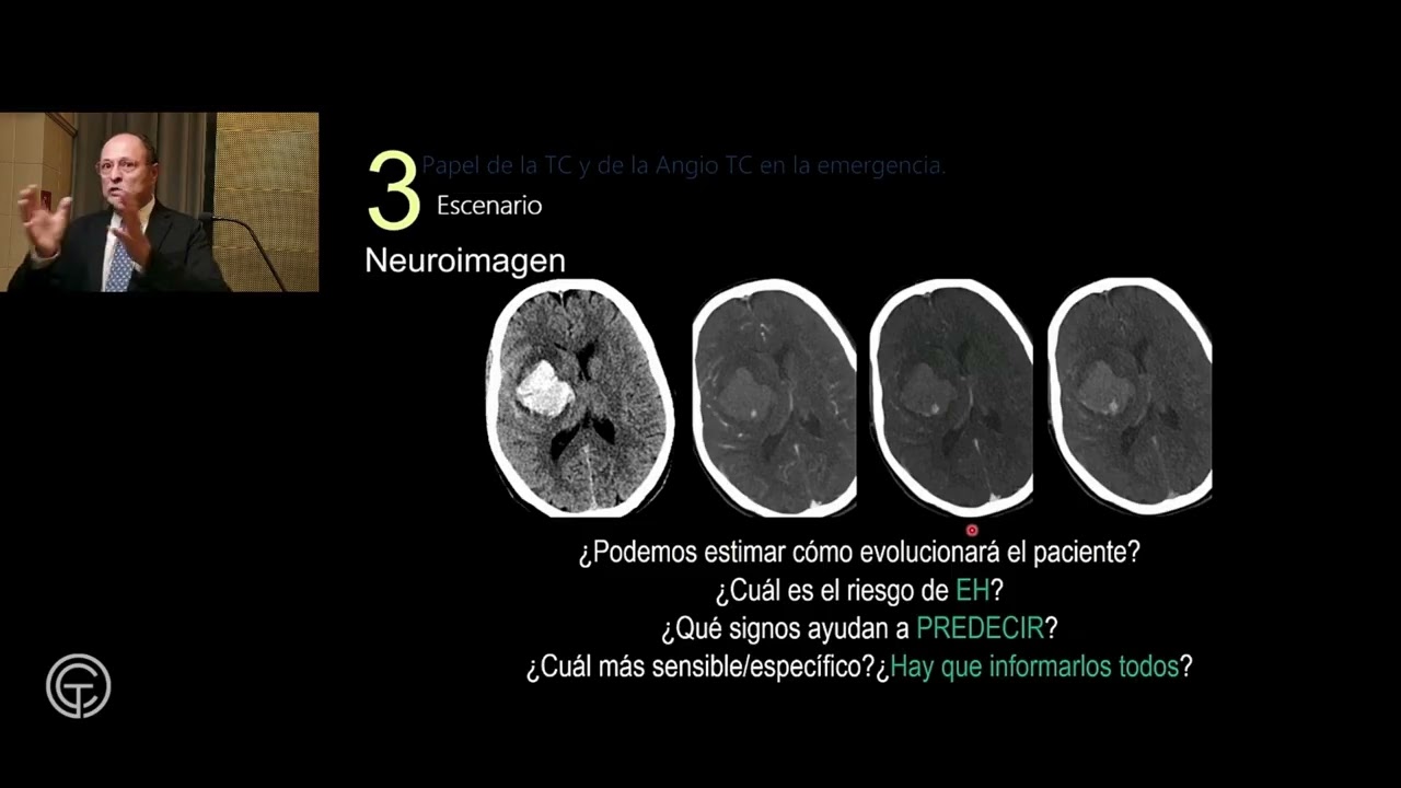 Factores predictores (pronósticos) de resangrado en hemorragia intracraneal