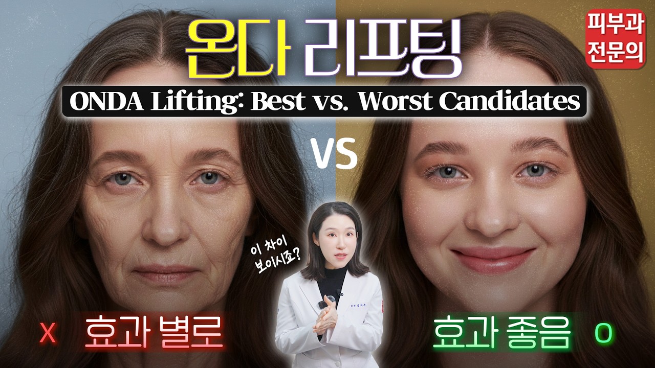 온다 리프팅, 내 얼굴에 과연 좋을까? Will ONDA Lifting work for my face? - 피부과전문의 [닥터필러]