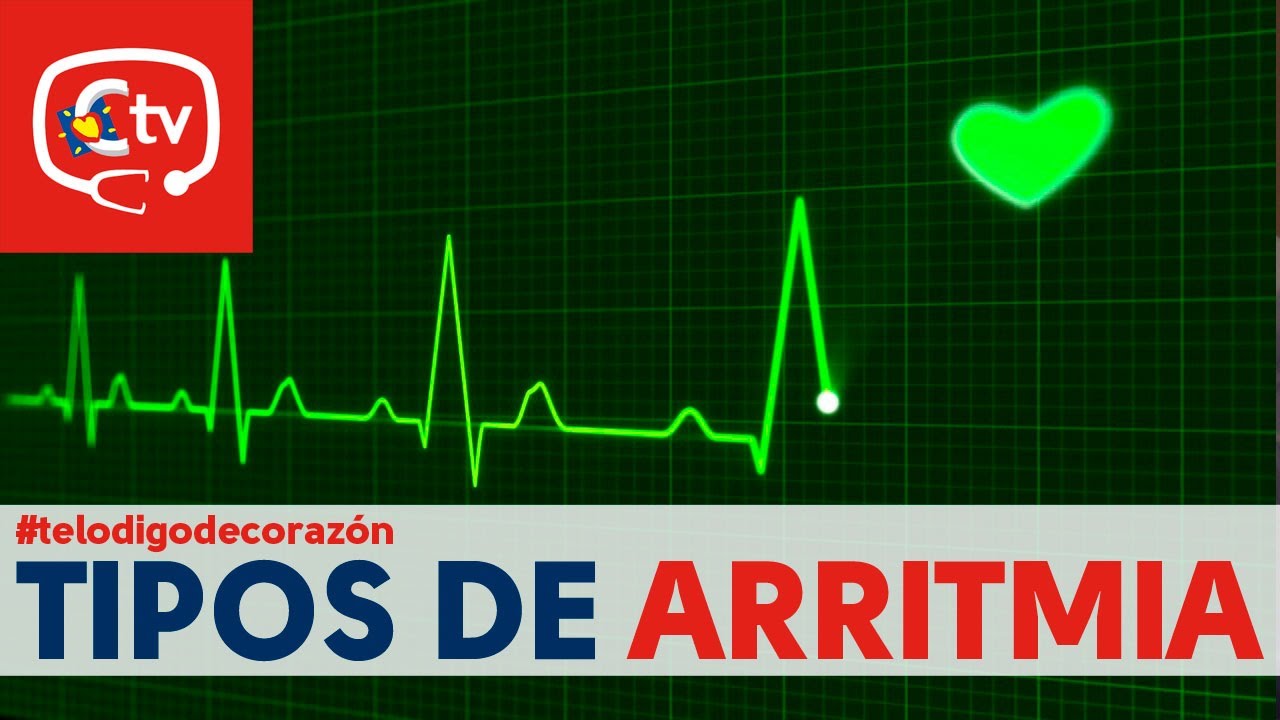 Tipos de arritmias: bradicardia y taquicardia #telodigodecoraz&oacute;n