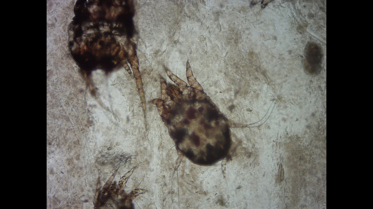 KOH technique for Ectoparasites 2023