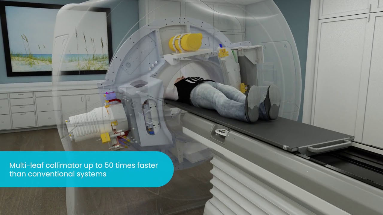 Treating Lung Tumors with Precision Radiation on the #Radixact System with Synchrony