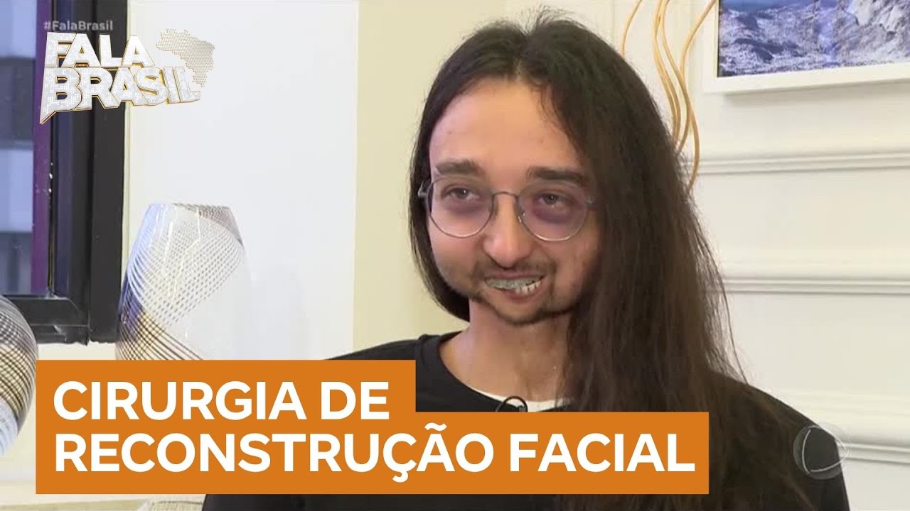 Arquiteto luta para conseguir prótese que vai devolver formato original de seu rosto